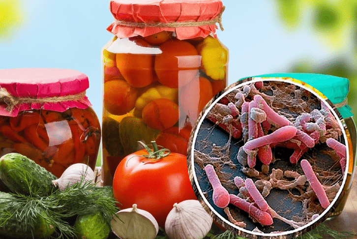 ботулізм у консерваціях